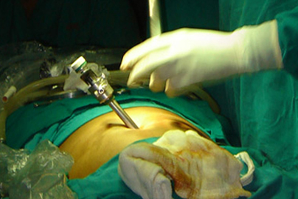 Hysteroscopy